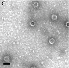 Iron oxide nanoparticles (NP-N2) encapsulated into brome mosaic virus (BMV) OTHER [STATIC IMAGE] model